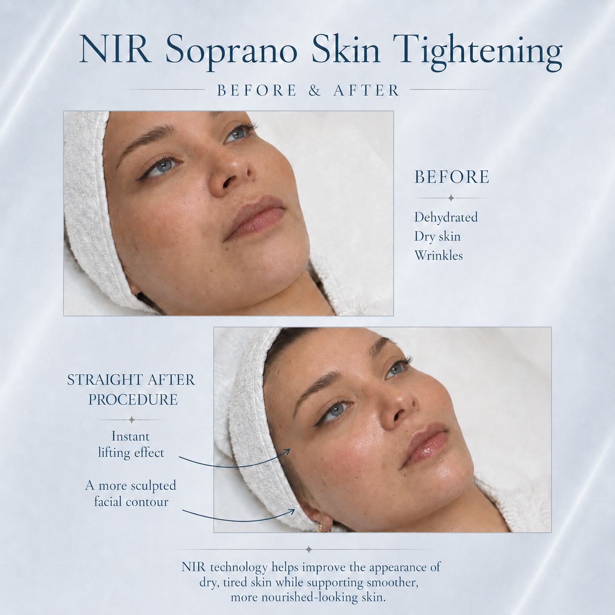 NIR Skin Tightening London | Face & Body | BeautyGene